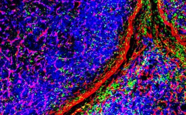 Würzburger in „Champions League der Myelom-Forschenden“