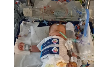 Hypothermieregister hilft bei Behandlung von Neugeborenen mit Sauerstoffmangel