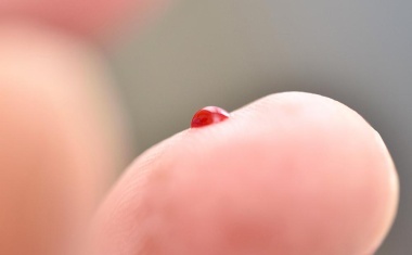 Risikofüße schützen: Amputationen gemeinsam verhindern