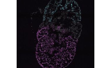 Erste Herzorganoide mit mehreren Kammern enthüllen Entwicklung und Erkrankung des Herzens