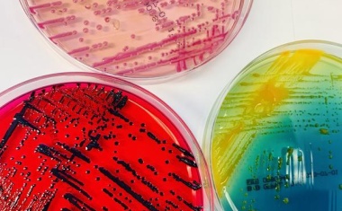 Über dreißig neue Bakterienarten in Patientenproben entdeckt