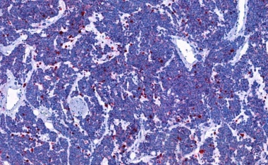 Krebs: Neue Therapieansätze durch genetische Passagiere