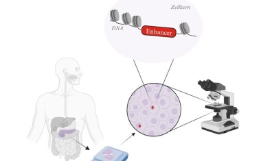 Bauchspeicheldrüsenkrebs: „Enhancer“ könnten bei der Vorhersage des Therapieerfolgs helfen