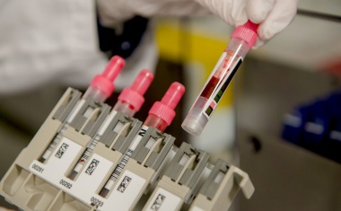 Diabetes einfach und sicher früh berechnen