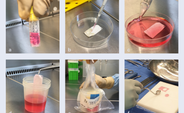 Wenn die Nase ins Knie geht