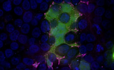 Neue Hoffnung im Kampf gegen RSV