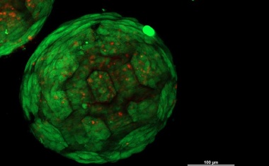 Mit Hilfe von 3D-Druck zu künstlichem Knorpel