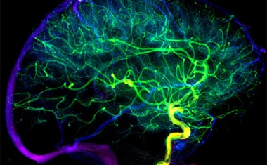 Arterienverbindungen verbessern Therapieerfolg nach Schlaganfall