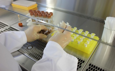 Welche Rolle spielt das Mikrobiom für die Alzheimer-Erkrankung?