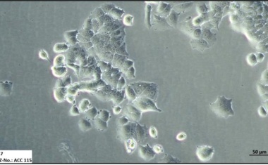 Krebsforschung: Forschende des Leibniz-Instituts DSMZ charakterisieren Brustkrebs-Zelllinien