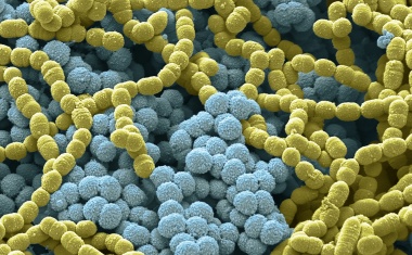 Welttuberkulosetag 2024: Neuer Blick auf alte Krankheit