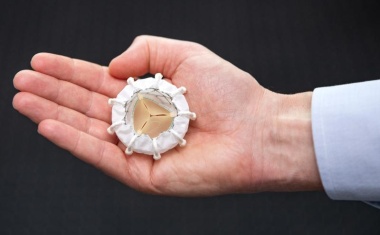 MHH-Kardiologie kann jetzt jede Herzklappe minimalinvasiv ersetzen