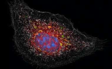 Studie entschlüsselt, wie Kortison Entzündungen dämpft