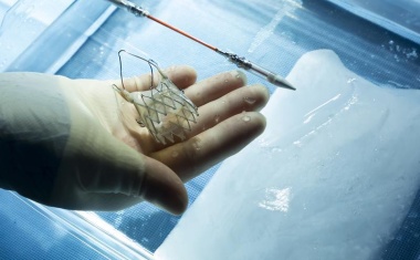 Kathetergestützter Aortenklappenersatz auch für jüngere und risikoärmere Patienten geeignet