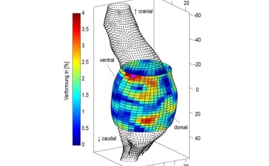 Bauchaortenaneurysma: Lebensbedrohliche Gefahr schneller identifizieren