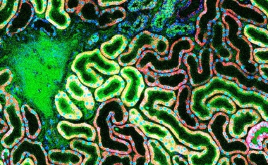 Neuer Therapieansatz zur Behandlung von cholämischer Nephropathie entdeckt