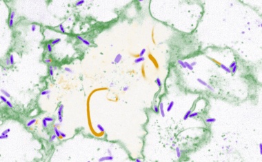 Der Feind im eigenen Körper: Wie sich Krankheitserreger unerkannt ausbreiten