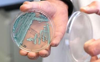 Deutliche Zunahme von Pilzinfektionen mit Candida auris in Deutschland