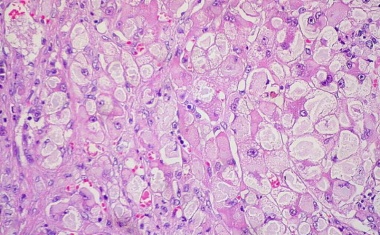 Mechanismen der Leberregeneration