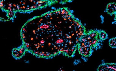 700.000 Euro für Präeklampsieforschung