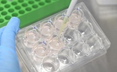 Hautmodelle als Alternative zu Tierversuchen