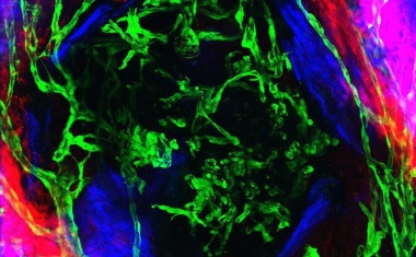 Blutgefäße: Pioniere der Knochenbildung im Schädel