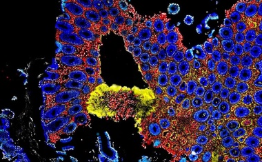 Darmmikrobiom im Fokus