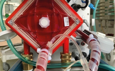 Neue Ansätze zur Blutungsprävention