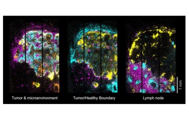 3D-Karten kranker Gewebe mit subzellulärer Präzision