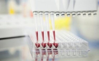 Neuartiger Bluttest hilft Krebstherapien zu verbessern