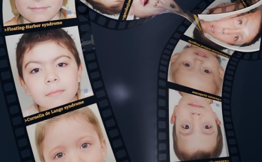 Genetische Diagnostik Ultra-Seltener Erkrankungen: Multizentrische Studie identifiziert 34 neue genetische Erkrankungen