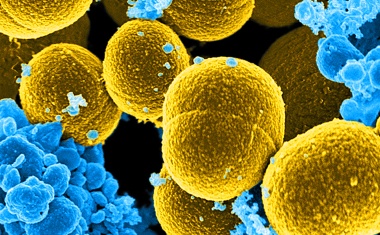Phagenlysin-Wirkstoff gegen Staphylococcus aureus: Start der klinischen Phase
