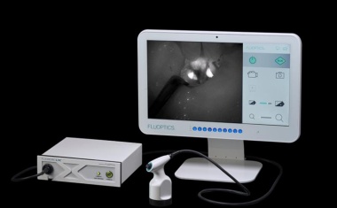 State of the Art Fluoreszenz-Bildgebung in der endokrinen Chirurgie