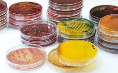 Infektionsdaten effizient melden