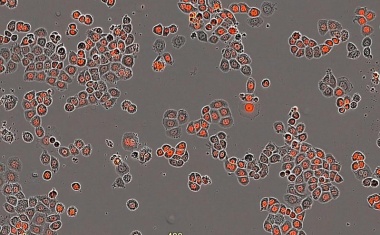 Wann ist die beste Tageszeit für eine Krebsbehandlung?