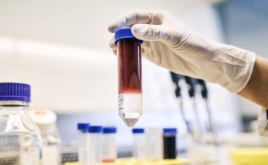 Kochsalz aktiviert Anti-Tumorzellen