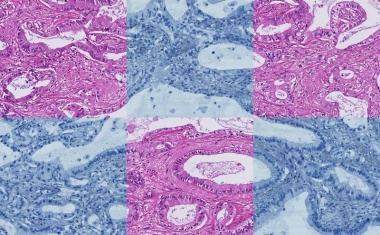 Dateneffizientes Basismodell für Biomarker-Erkennung