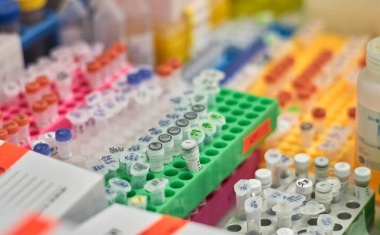 Genom-Editierung mit neuer kompakter „Genschere“