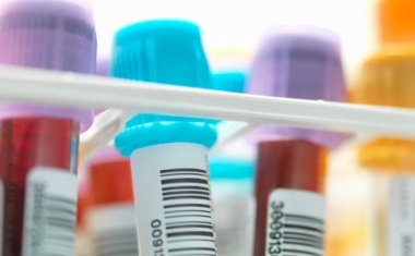 KI soll Diagnostik verbessern