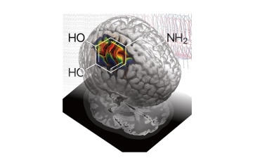 Parkinson: Hirnstimulation kann Dopamineffekt nachahmen