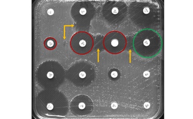 KI hilft bei der Erkennung antibiotikaresistenter Bakterien