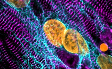 Gentherapie verbessert Herzfunktion bei hypertropher Kardiomyopathie