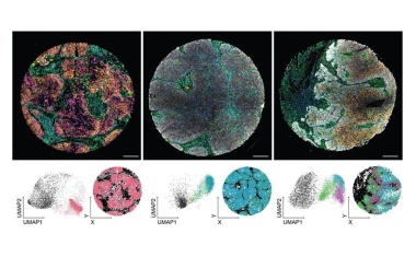 Eigenschaften von Krebszellen genau analysieren