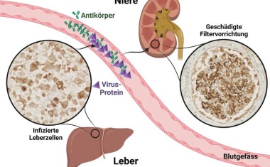 Wieso eine Leberentzündung die Nieren schädigen kann