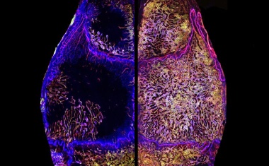 Gefäßwachstum im alternden Körper