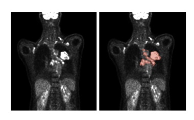 Künstliche Intelligenz: Algorithmen verbessern Analyse medizinischer Bilder