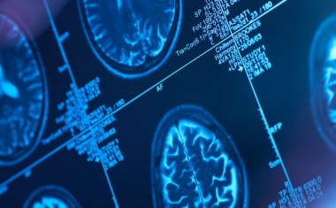 Erprobungsstudie prüft Nutzen von Amyloid-PET bei „unklarer Demenz“