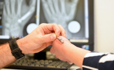 Bergmannsheil versorgt 100. Patientin mit innovativem Gelenkersatz