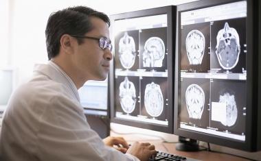 Algorithmus für besonders exakte Beurteilung von Hirnschäden