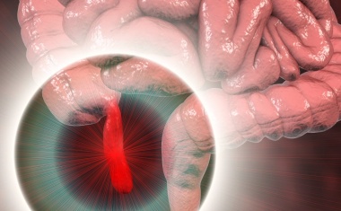 Blinddarmentzündung bei Kindern und Jugendlichen